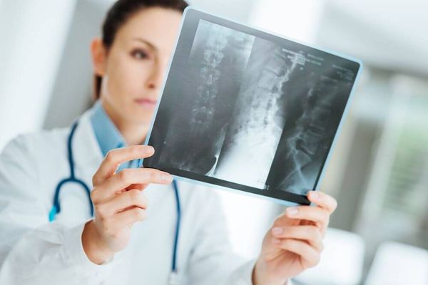 Какие анализы нужно сдать при остеопорозе